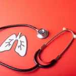 Dinkes Solo Temukan 405 Kasus TBC, Tracing Kontak Erat di Mojosongo dan Jebres