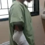 Tragis, Gadis di Semarang Jadi Korban Dugaan Pembakaran oleh Keluarga