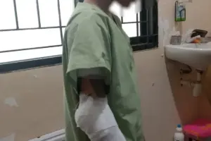 Tragis, Gadis di Semarang Jadi Korban Dugaan Pembakaran oleh Keluarga