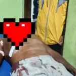 Petani di Sikka Diserang Buaya Saat Mandi Laut, Selamat Usai Melawan