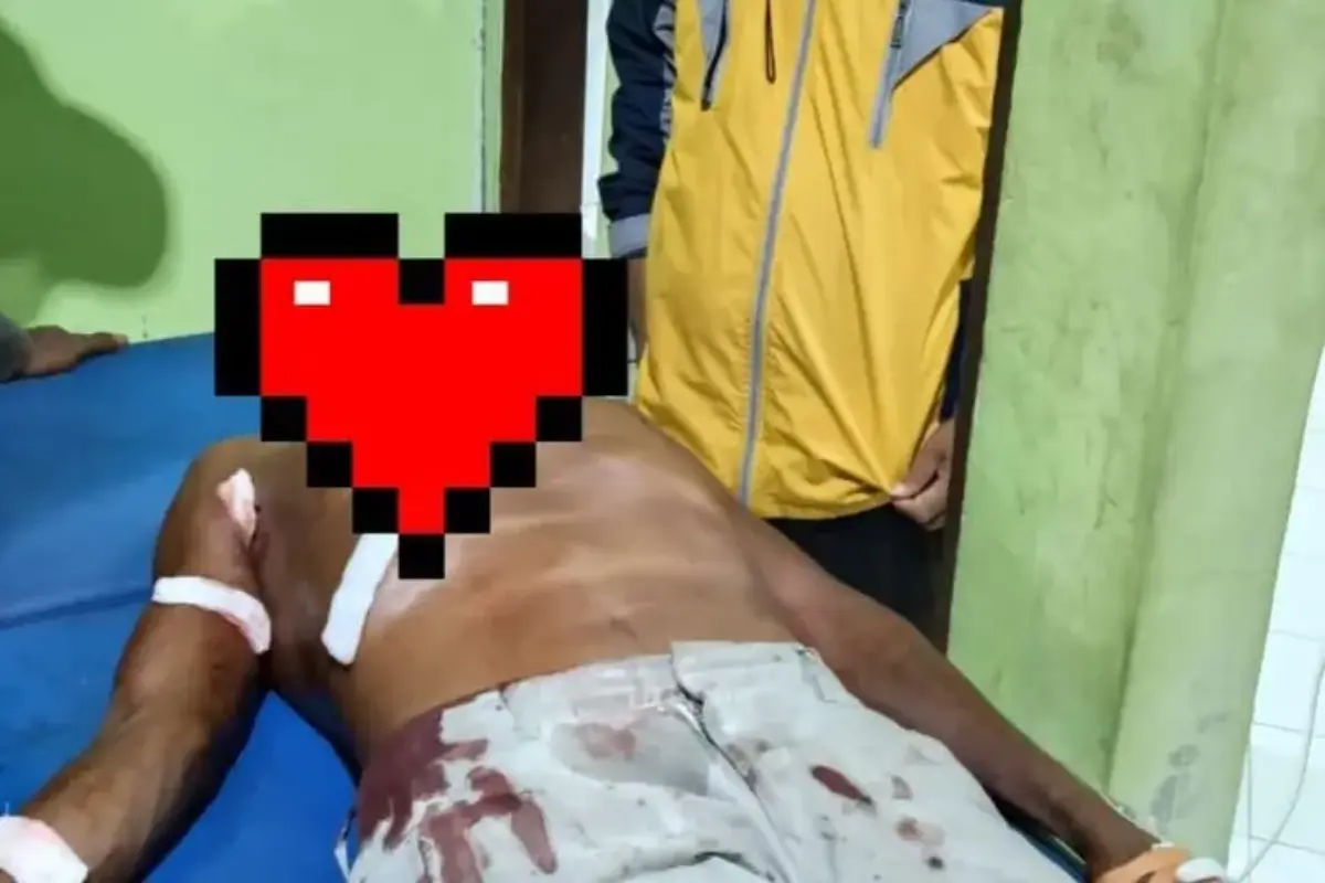 Petani di Sikka Diserang Buaya Saat Mandi Laut, Selamat Usai Melawan